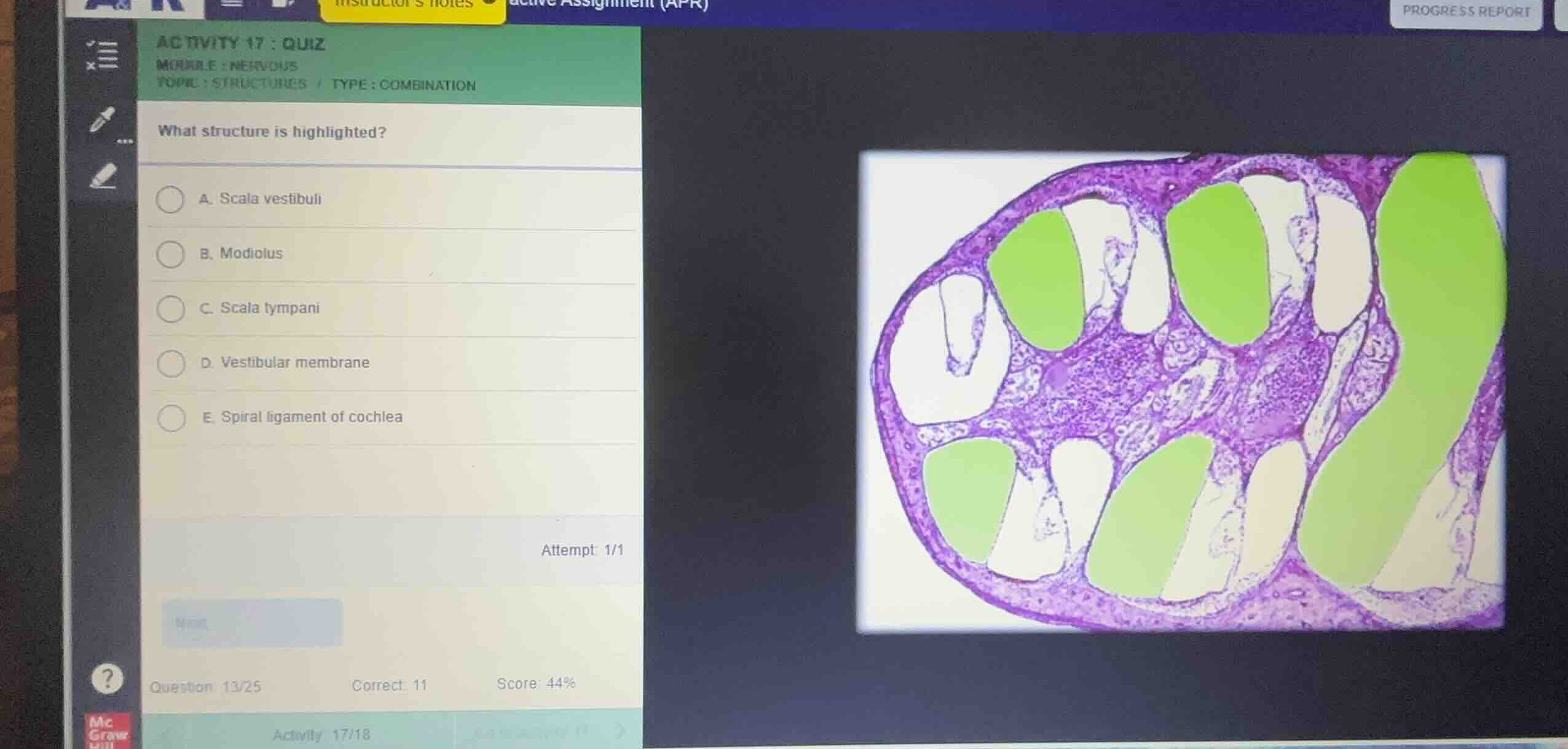 activity 17: quiz module: nervous topic: structures / type: combination…