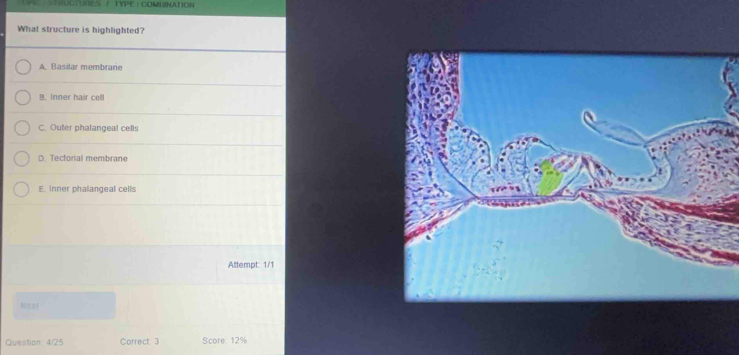 what structure is highlighted? a. basilar membrane b. inner hair cell c…