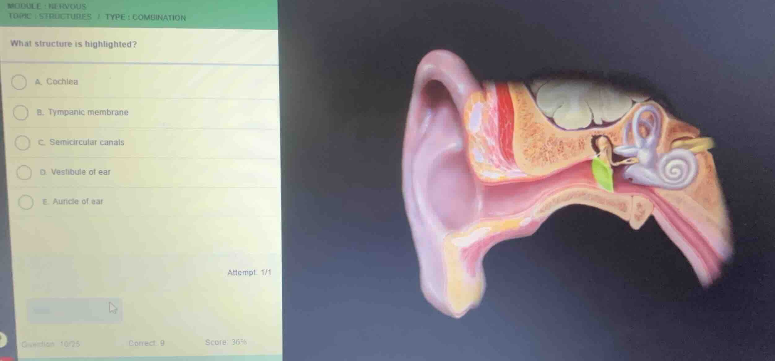 module: nervous topic: structures / type: combination what structure is…
