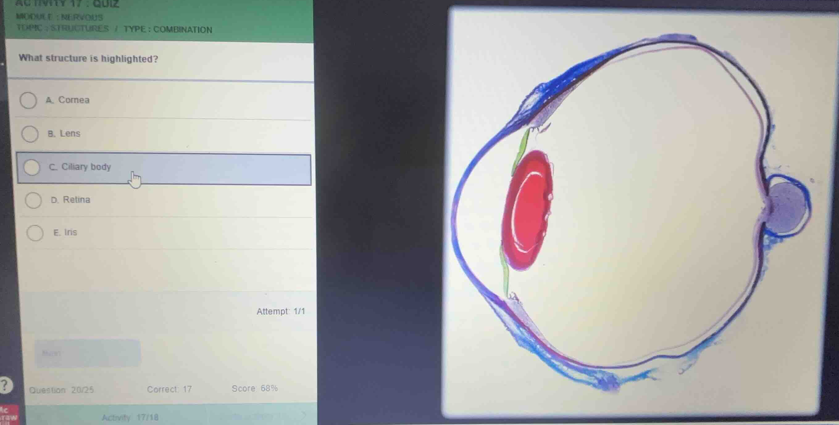 what structure is highlighted? a. cornea b. lens c. ciliary body d. ret…