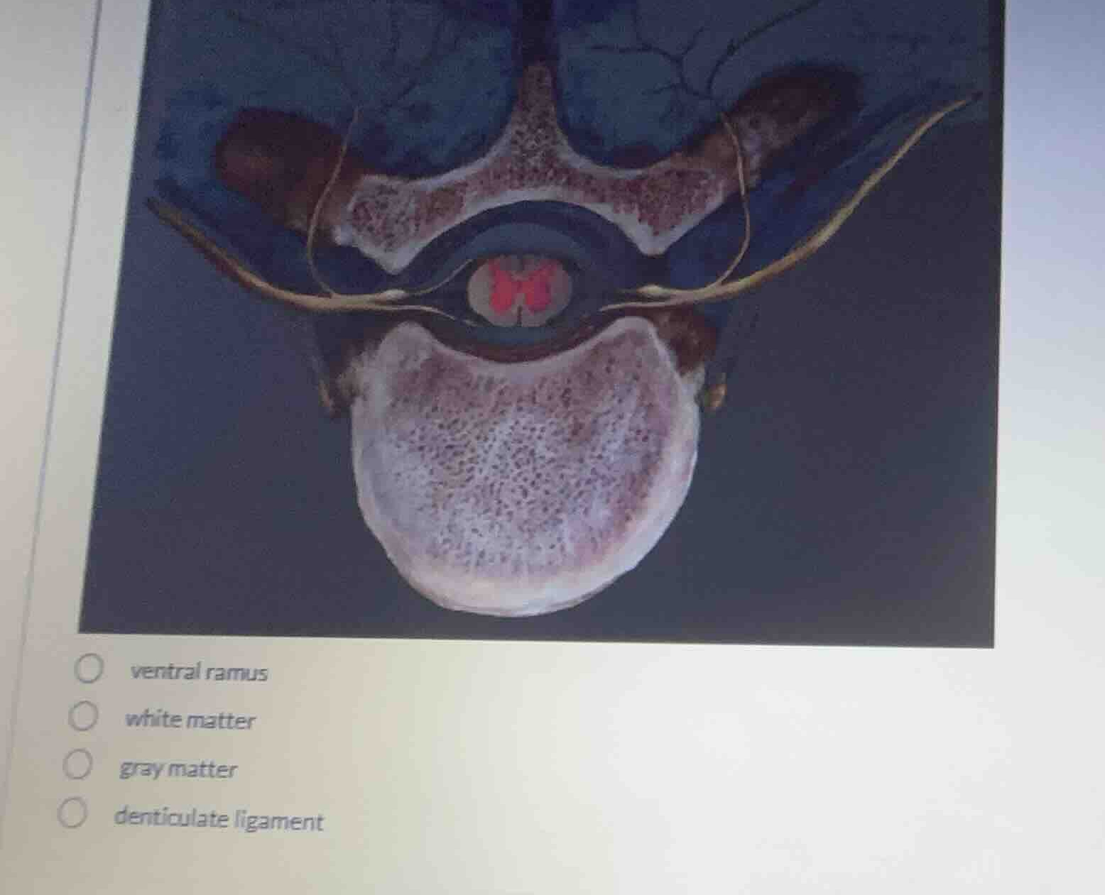 ventral ramus white matter gray matter denticulate ligament