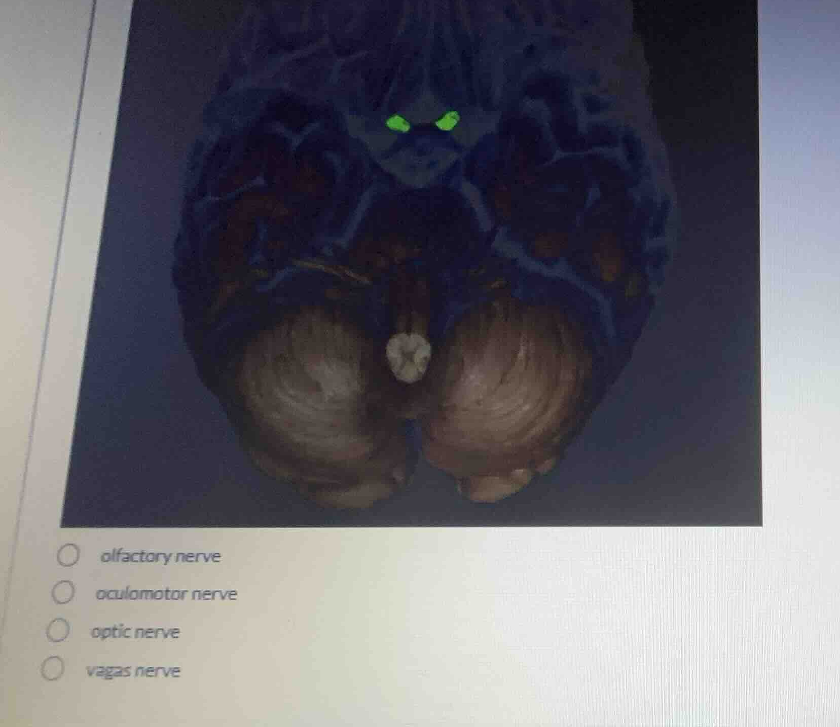 olfactory nerve oculomotor nerve optic nerve vagas nerve