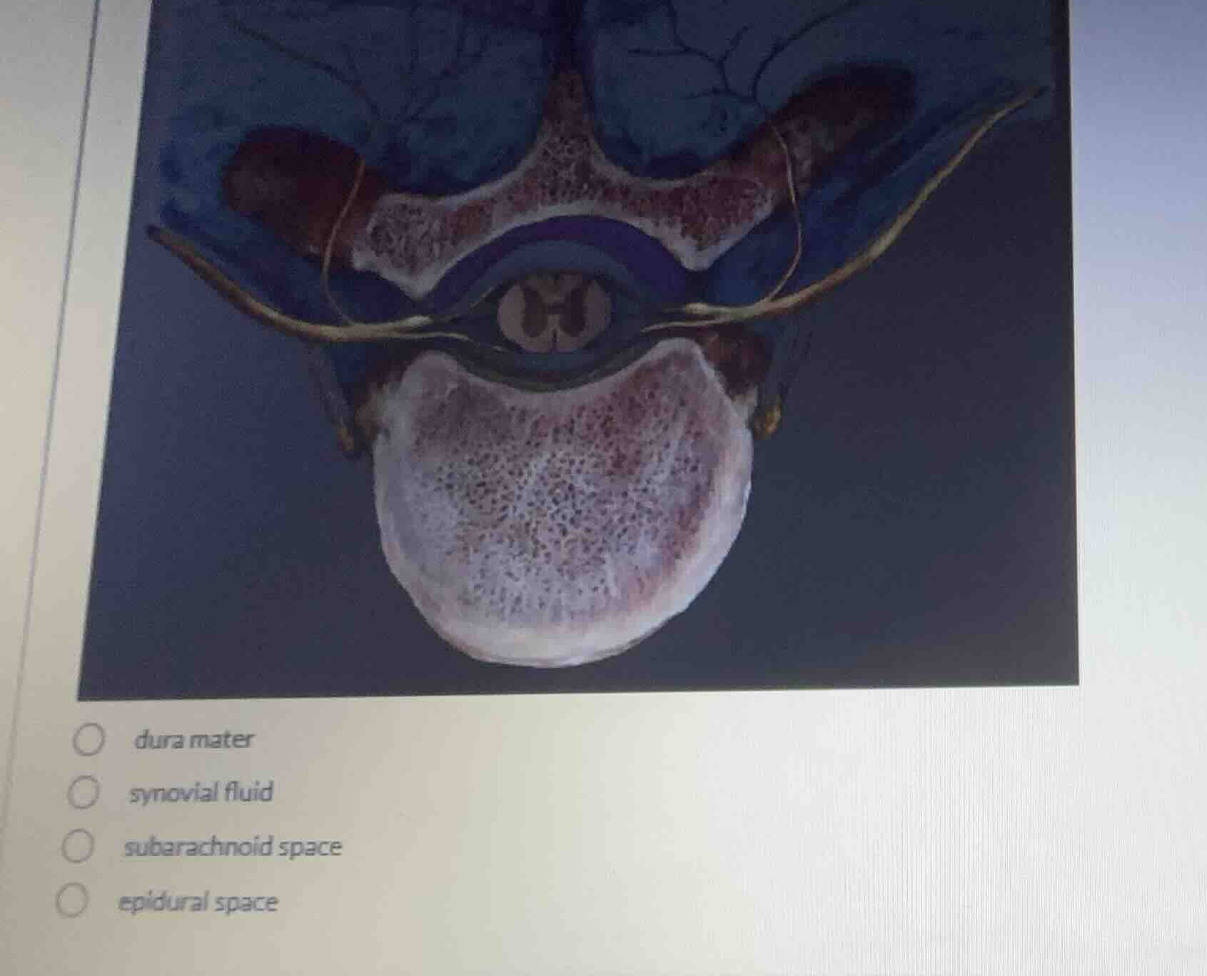 dura mater synovial fluid subarachnoid space epidural space