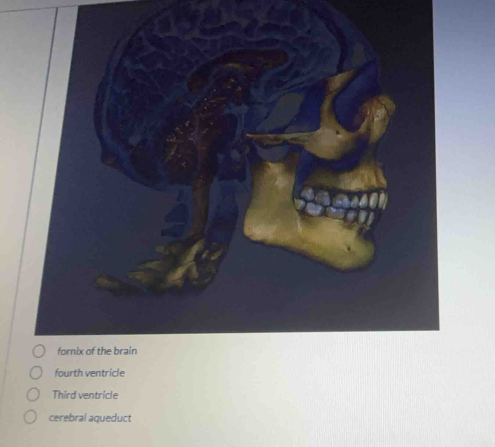 fornix of the brain fourth ventricle third ventricle cerebral aqueduct