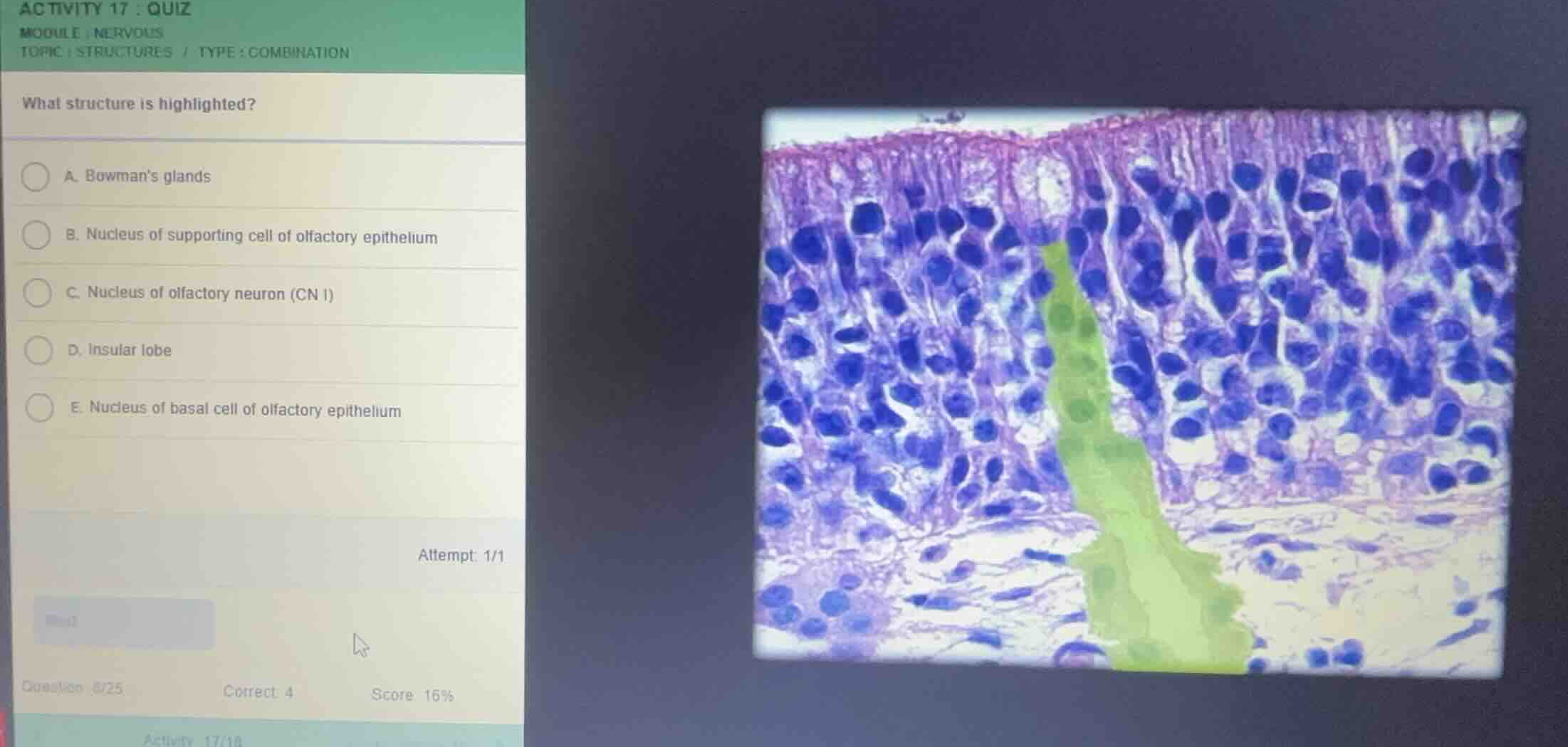 what structure is highlighted? a. bowmans glands b. nucleus of supporti…