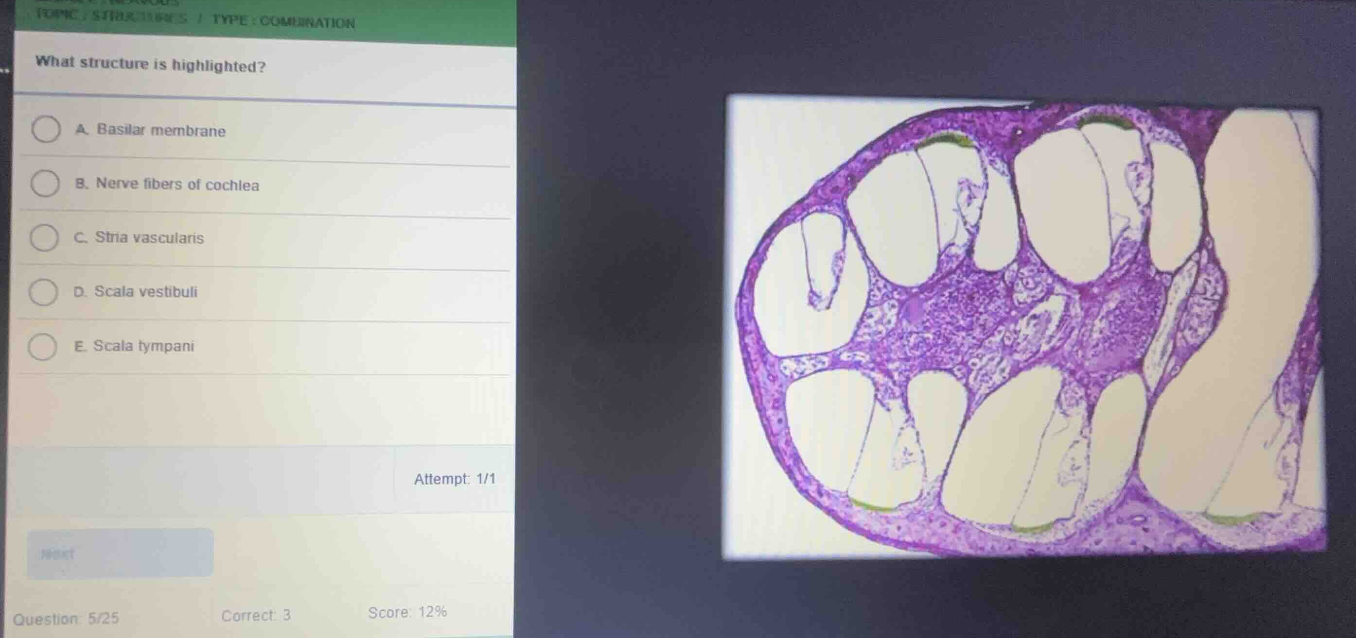 what structure is highlighted? a. basilar membrane b. nerve fibers of c…