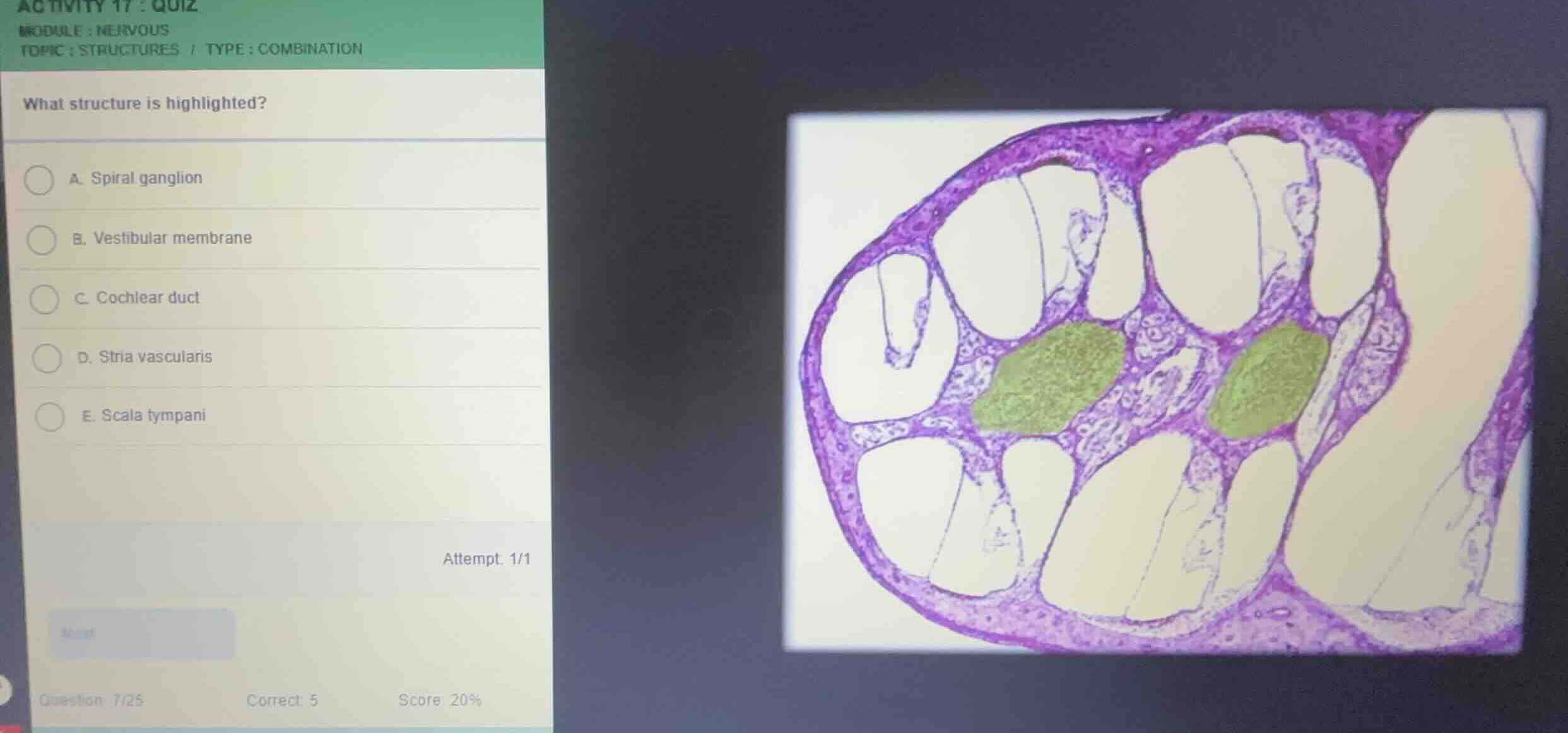 what structure is highlighted? a. spiral ganglion b. vestibular membran…