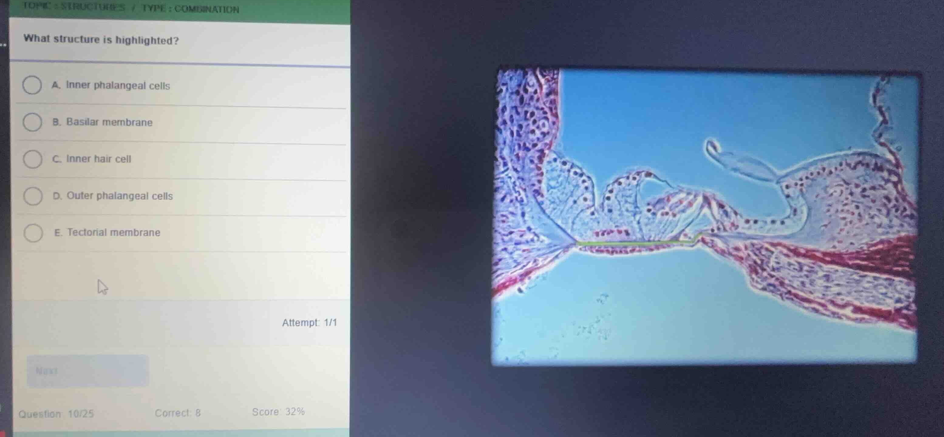 what structure is highlighted? a. inner phalangeal cells b. basilar mem…