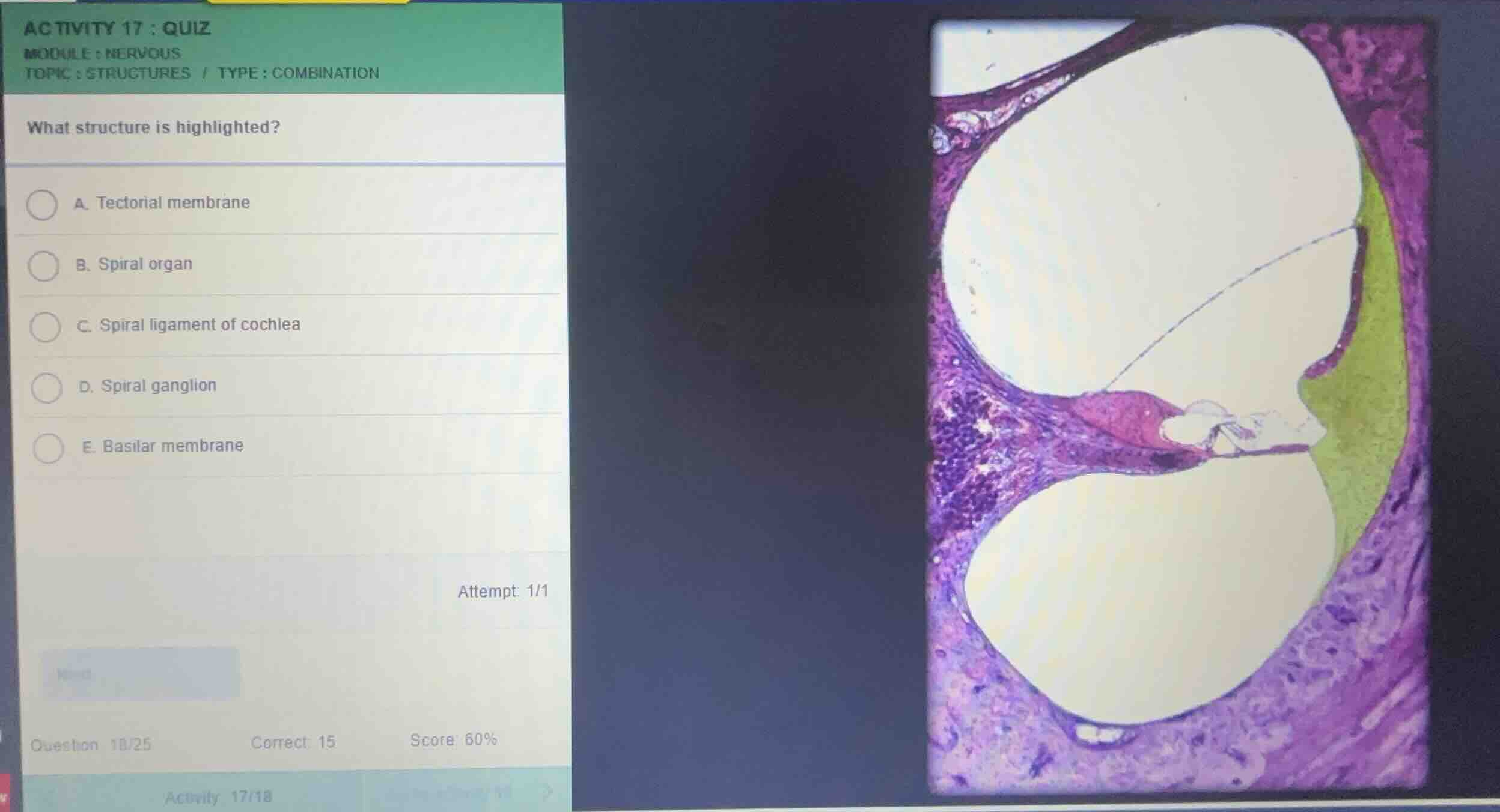 activity 17: quiz module: nervous topic: structures / type: combination…