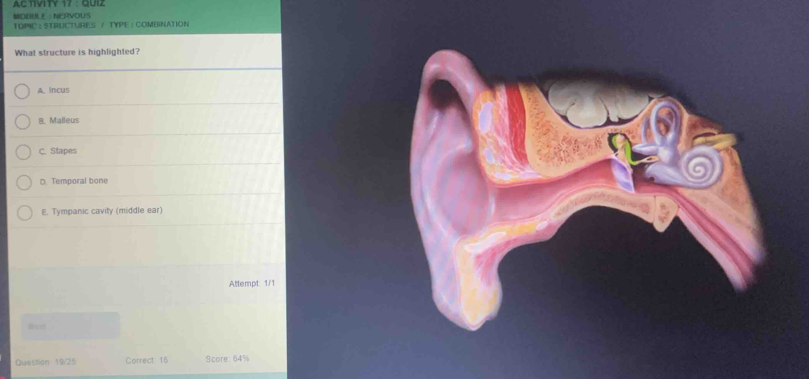 activity 17 : quiz module : nervous topic : structures / type : combina…
