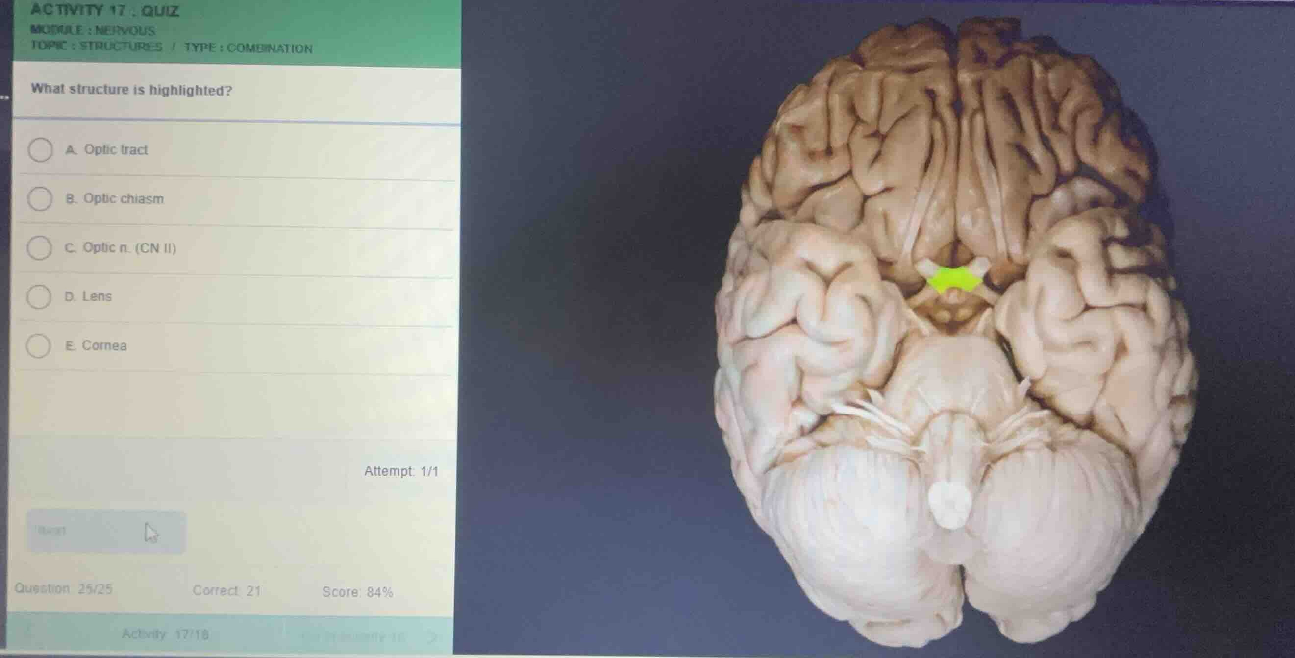 activity 17: quiz module: nervous topic: structures / type: combination…