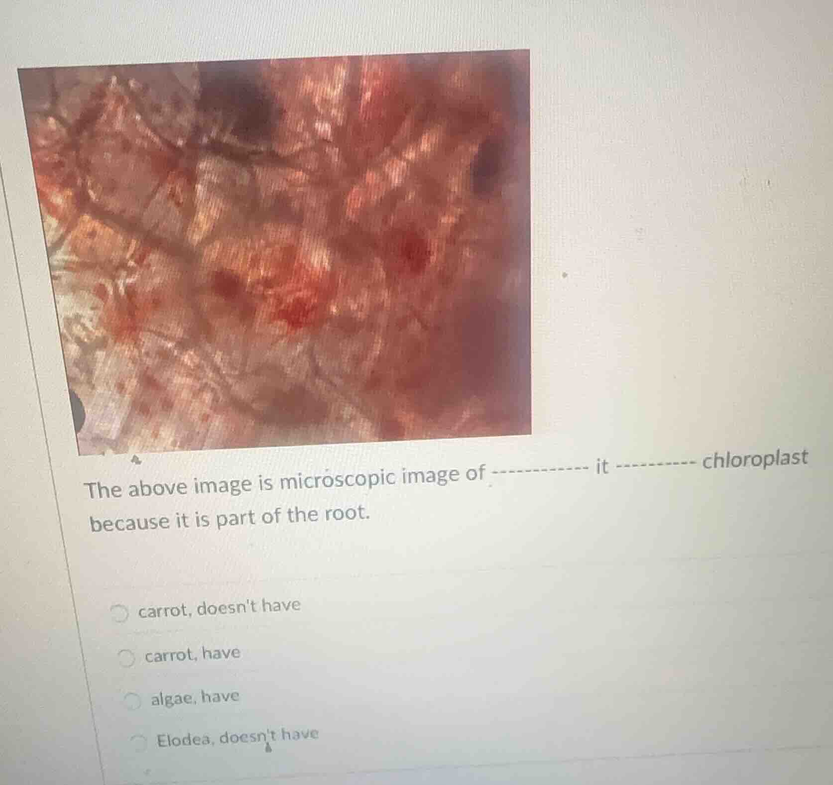 the above image is microscopic image of ---------- it ---------- chloro…