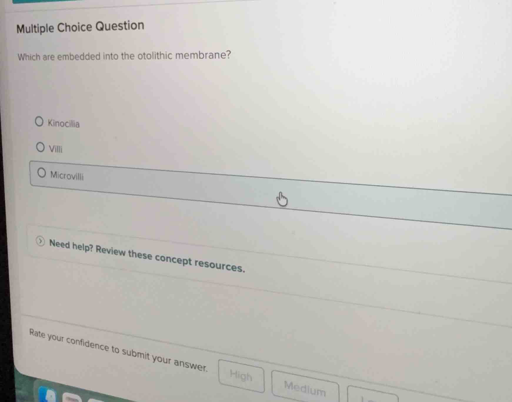 multiple choice question which are embedded into the otolithic membrane…