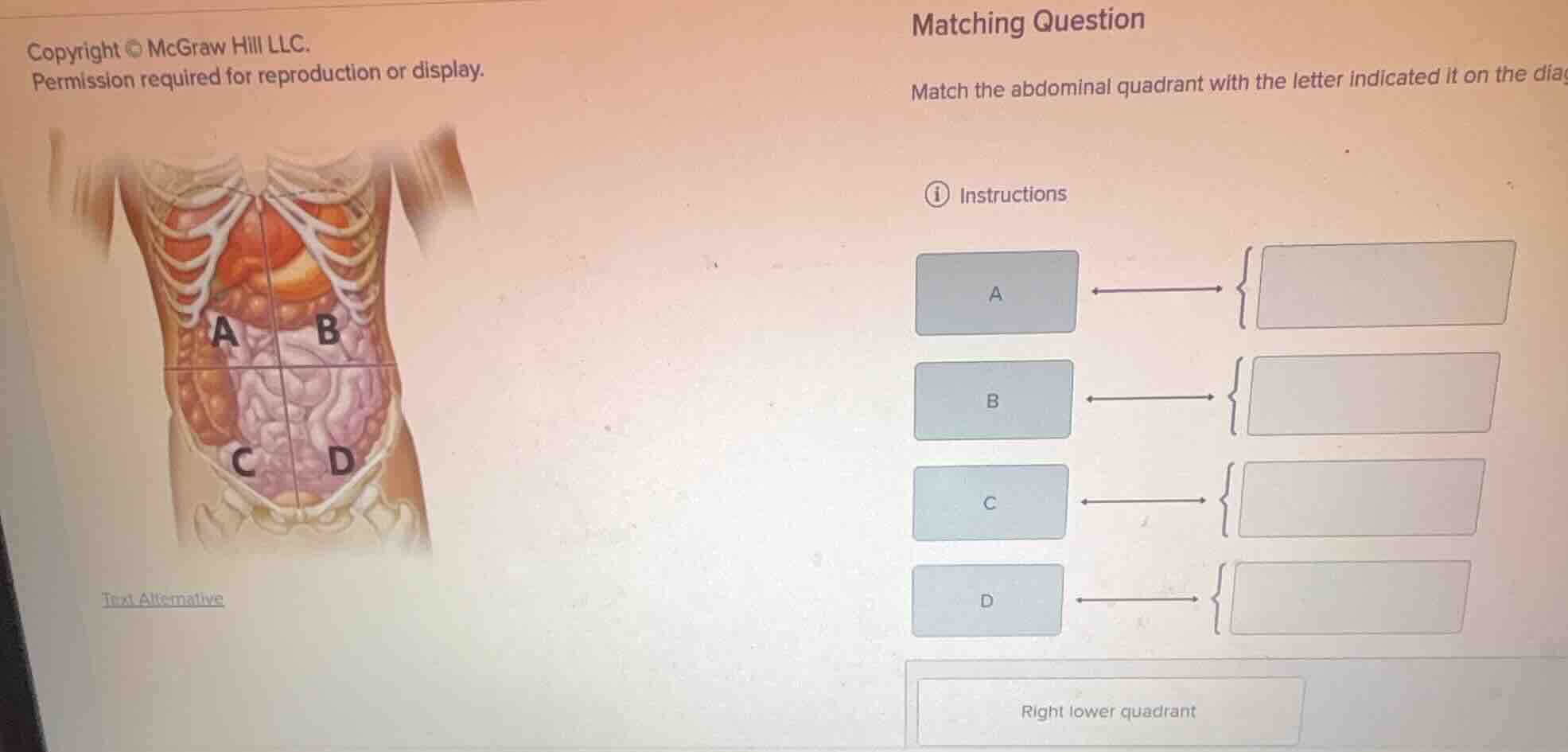 matching question match the abdominal quadrant with the letter indicate…