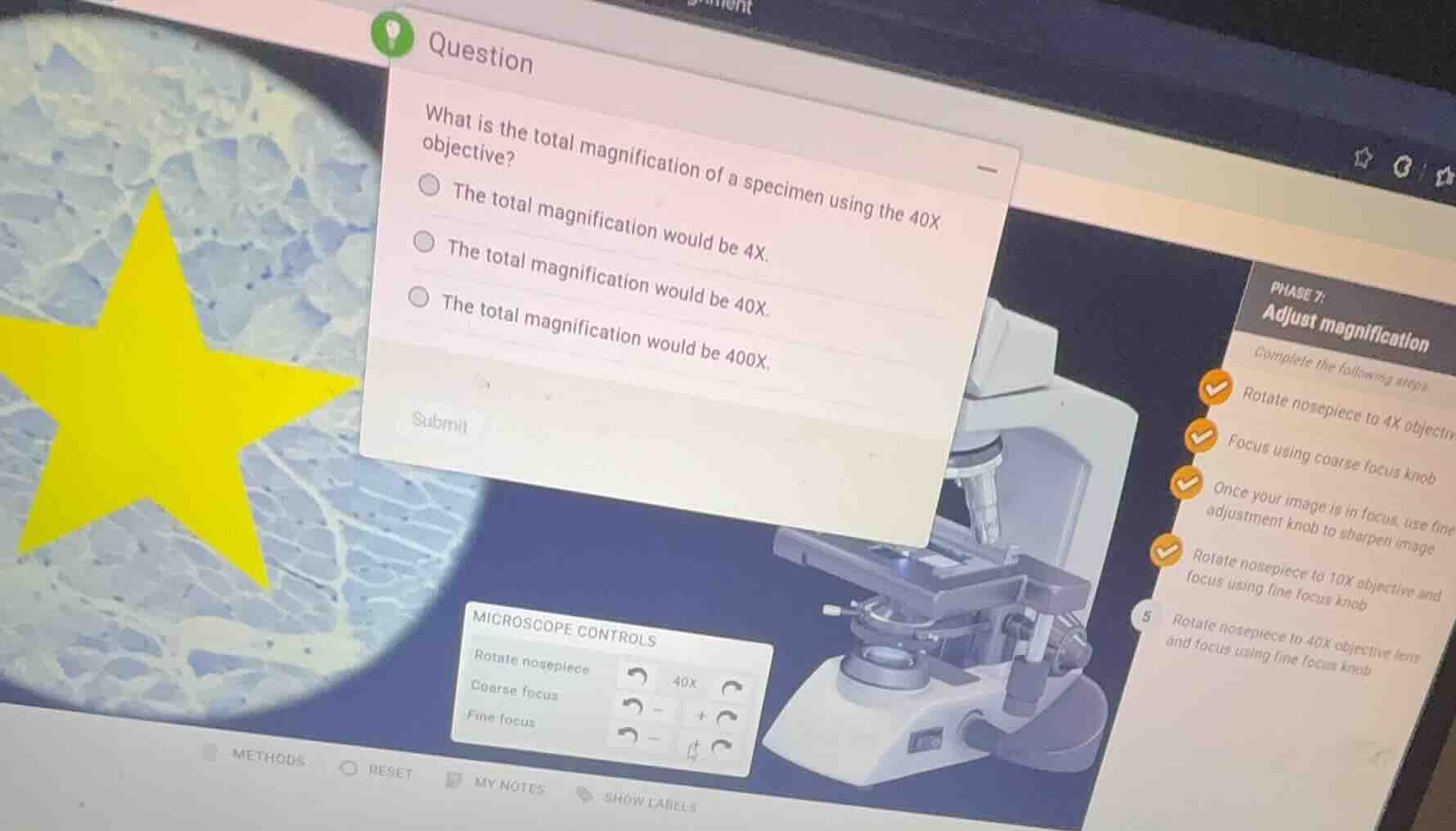question what is the total magnification of a specimen using the 40x ob…