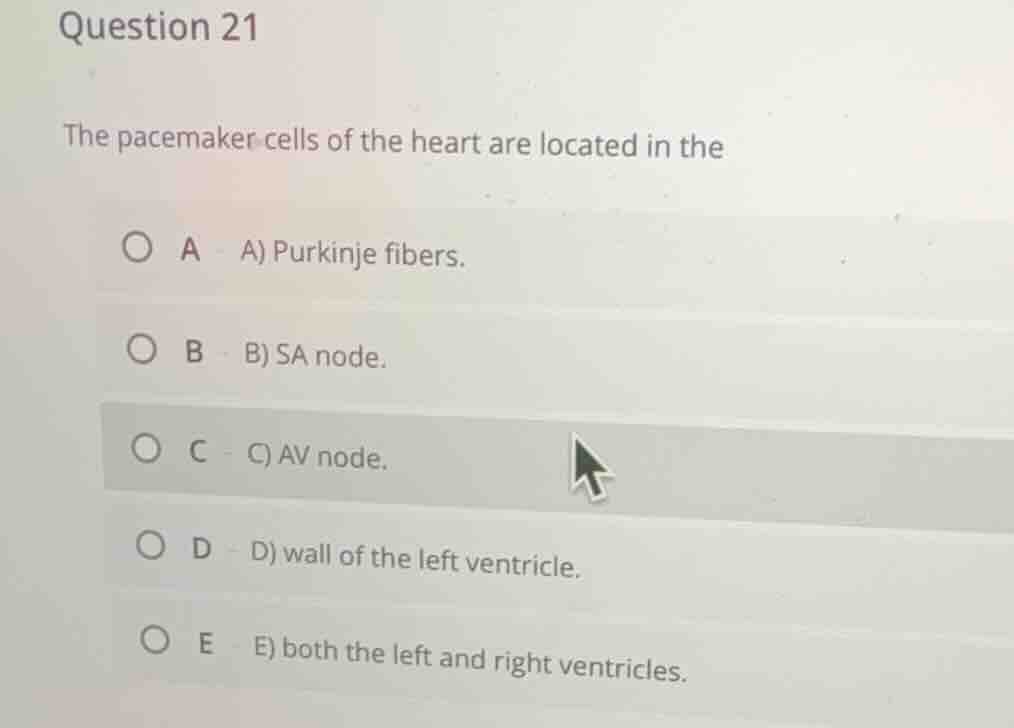 question 21 the pacemaker cells of the heart are located in the a) purk…