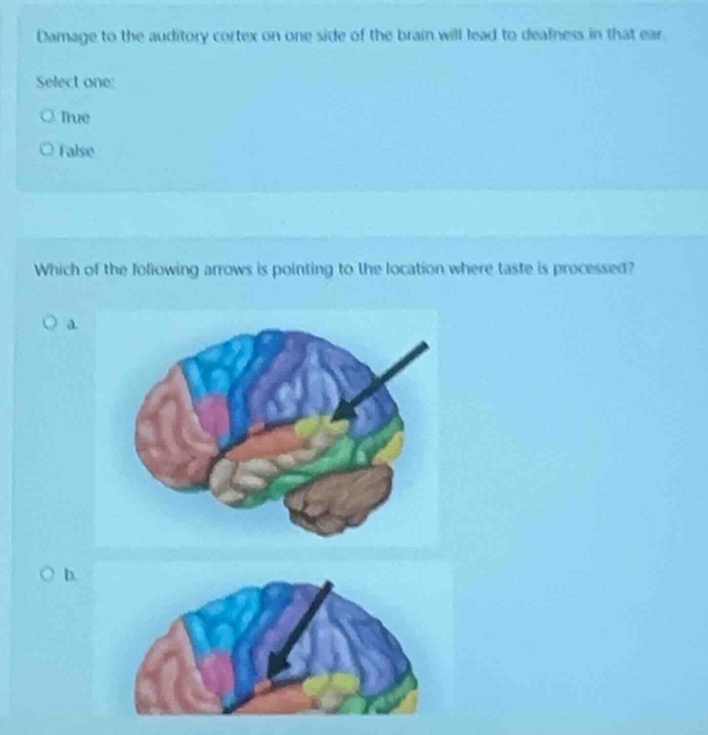 damage to the auditory cortex on one side of the brain will lead to dea…