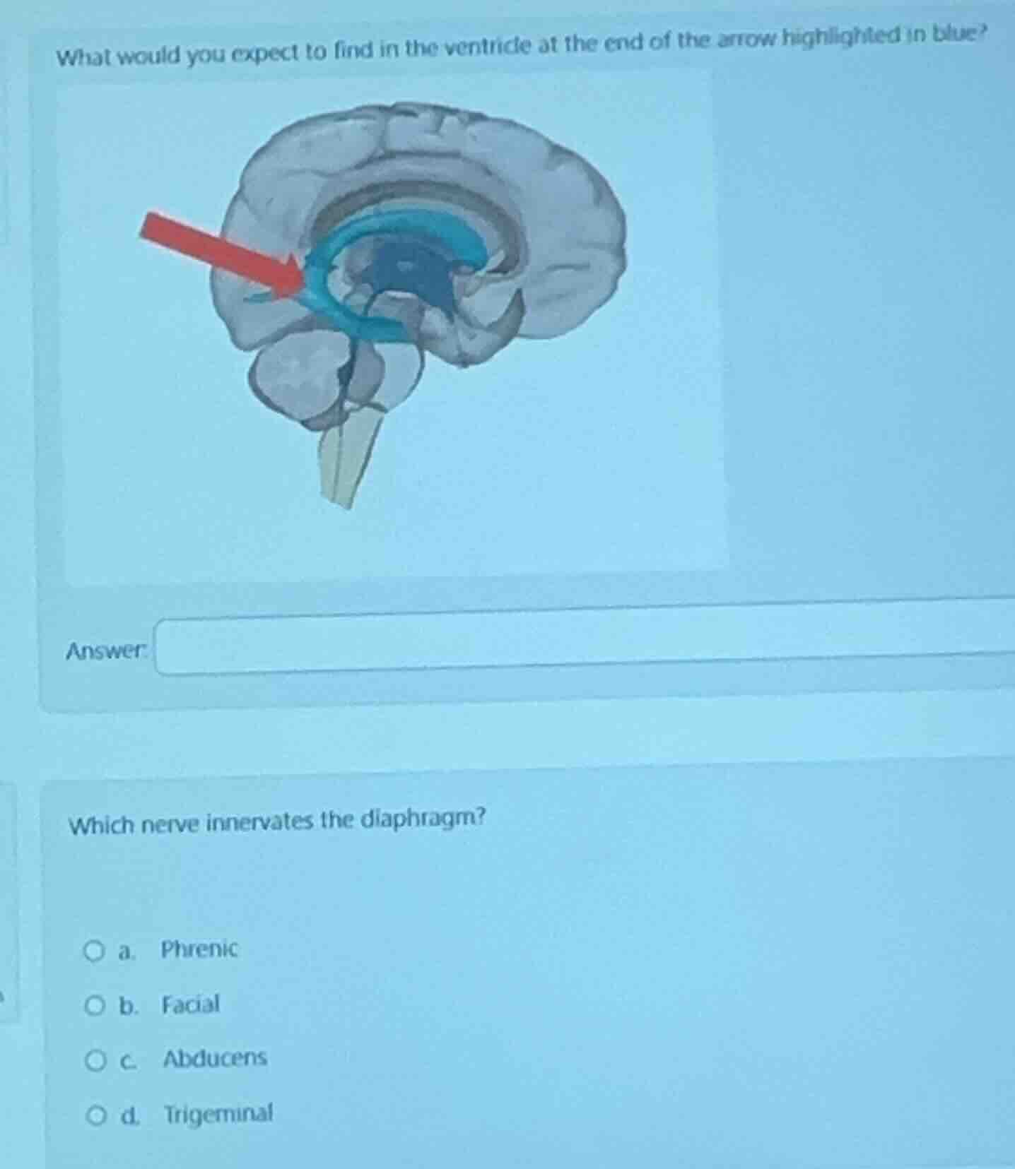 what would you expect to find in the ventricle at the end of the arrow …