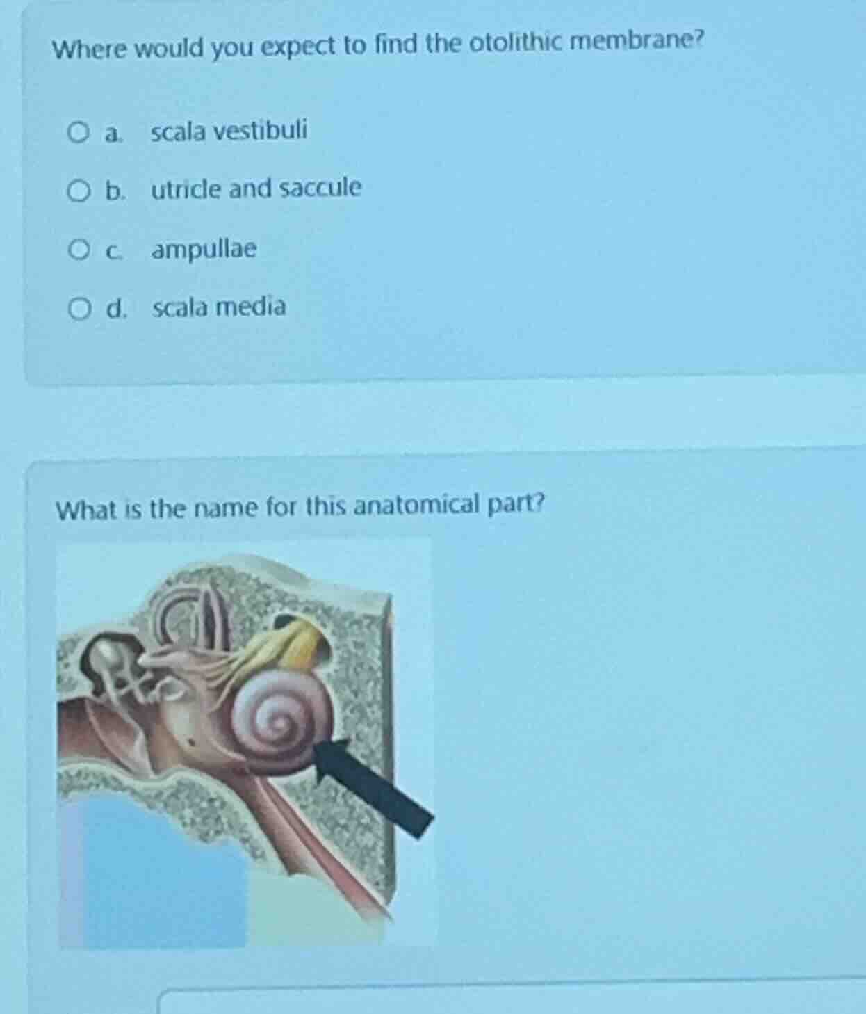 where would you expect to find the otolithic membrane? a. scala vestibu…