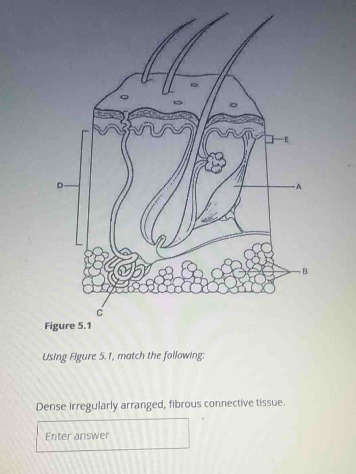 figure 5.1 using figure 5.1, match the following: dense irregularly arr…