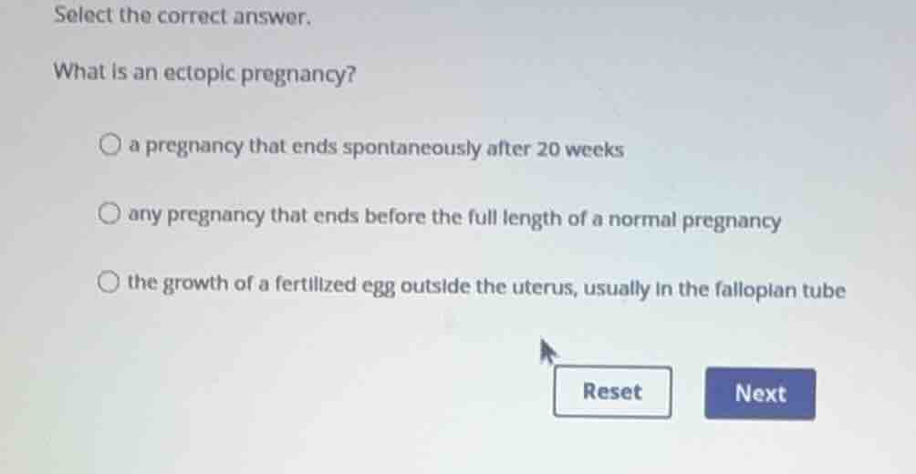 select the correct answer. what is an ectopic pregnancy? a pregnancy th…