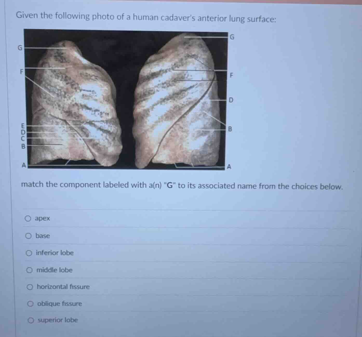 given the following photo of a human cadavers anterior lung surface: ma…
