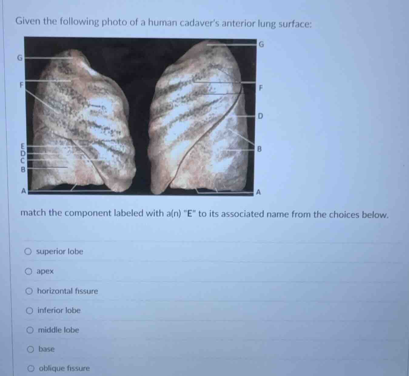 given the following photo of a human cadavers anterior lung surface: ma…