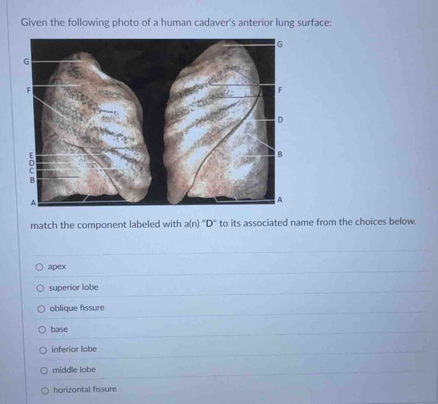 given the following photo of a human cadavers anterior lung surface: ma…