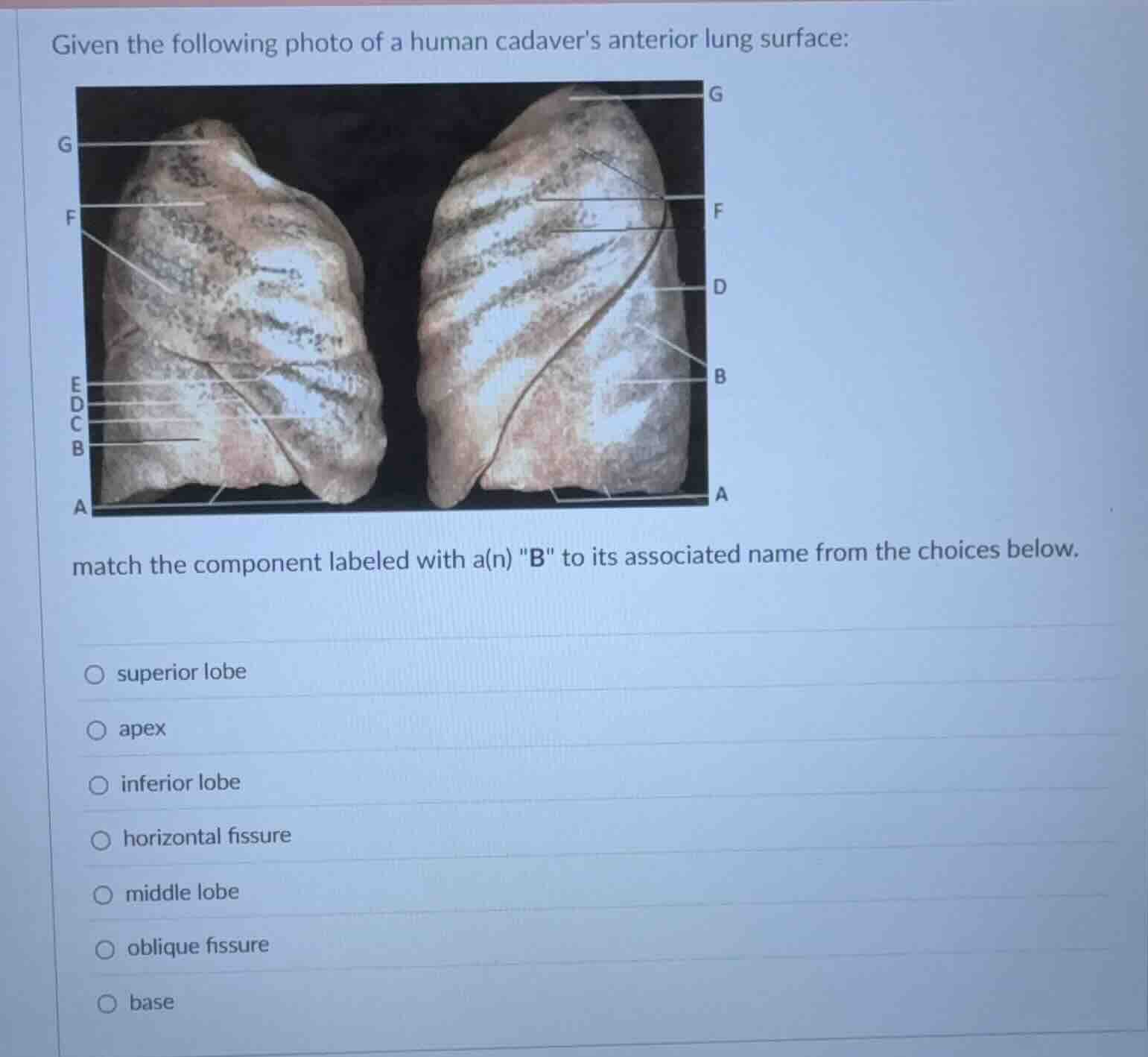 given the following photo of a human cadavers anterior lung surface: ma…