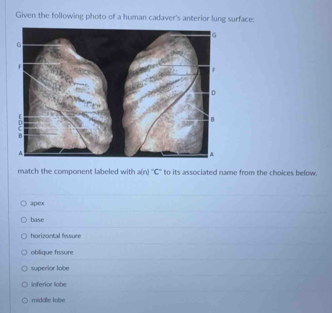 given the following photo of a human cadavers anterior lung surface: ma…