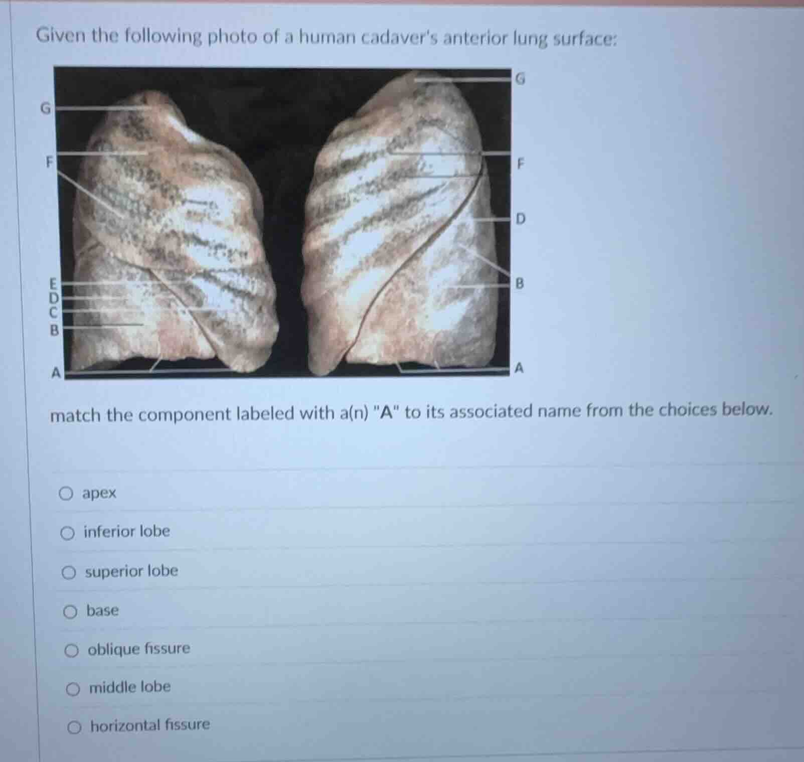 given the following photo of a human cadavers anterior lung surface: ma…