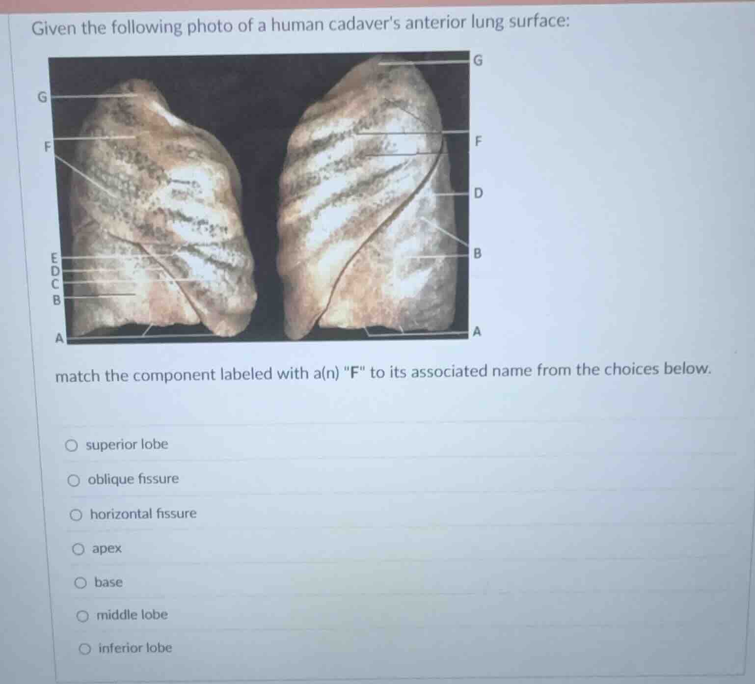 given the following photo of a human cadavers anterior lung surface: ma…