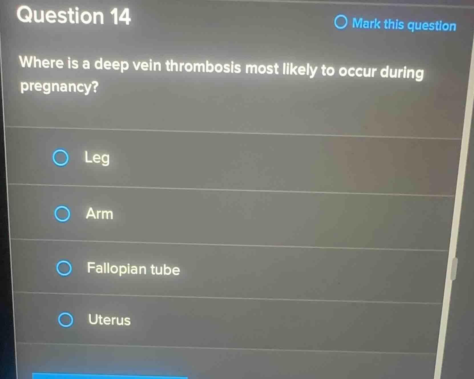 question 14 where is a deep vein thrombosis most likely to occur during…