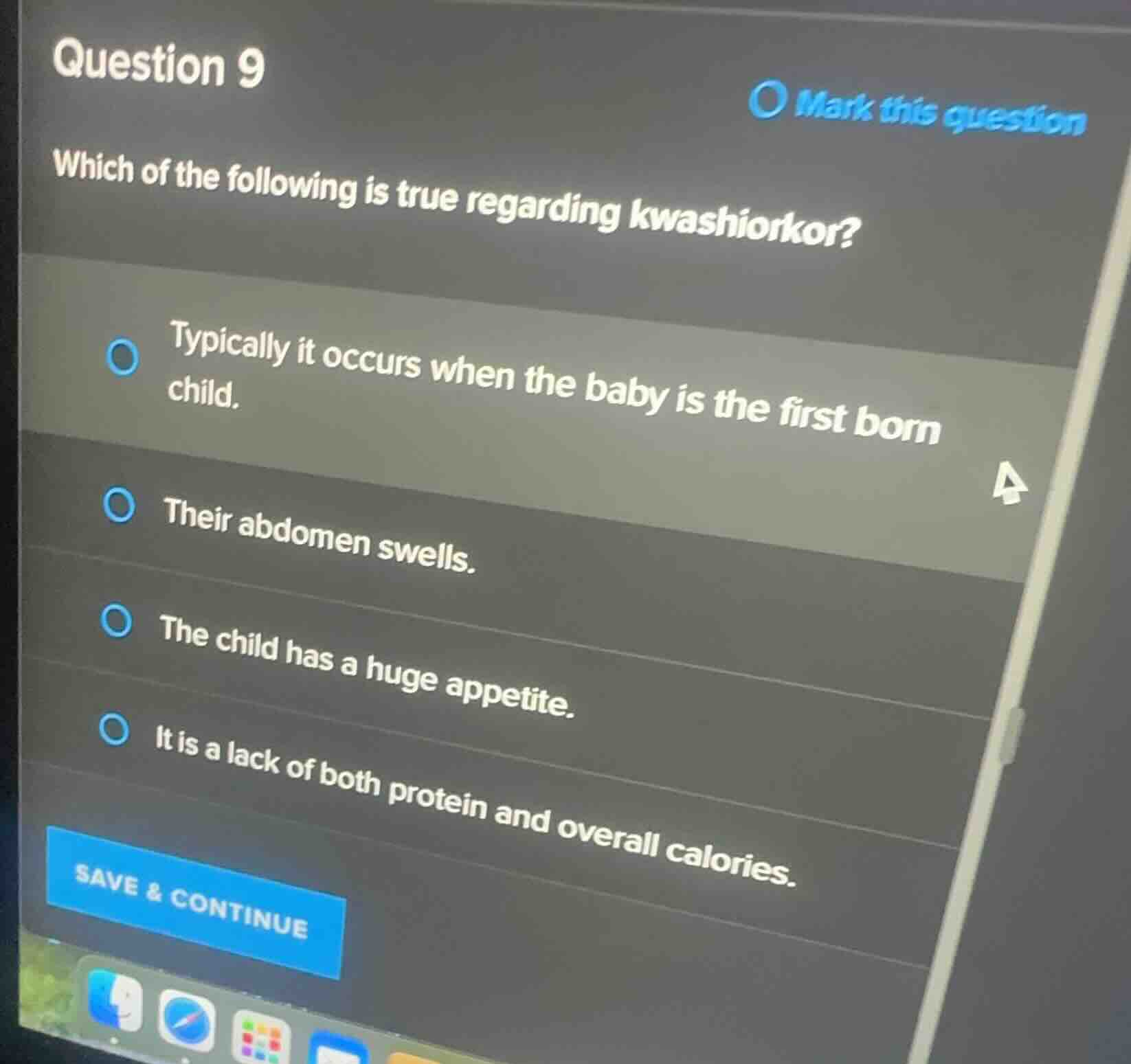 question 9 which of the following is true regarding kwashiorkor? typica…