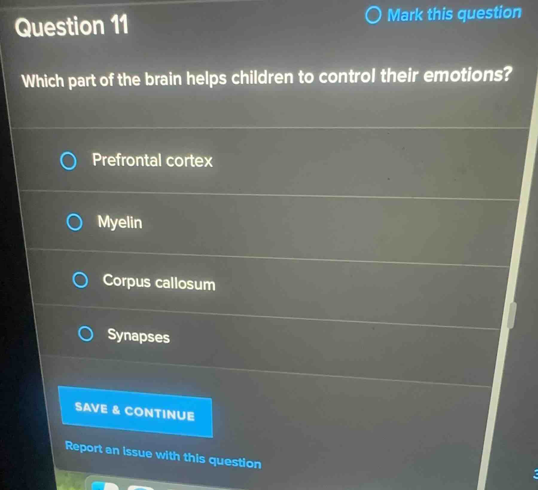 question 11 which part of the brain helps children to control their emo…