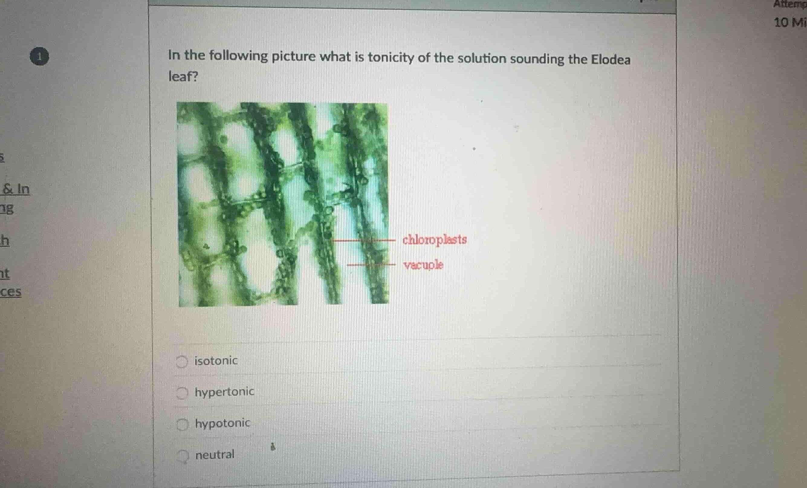 in the following picture what is tonicity of the solution sounding the …